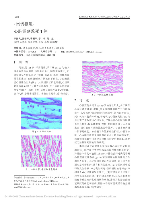 心脏震荡致死1例