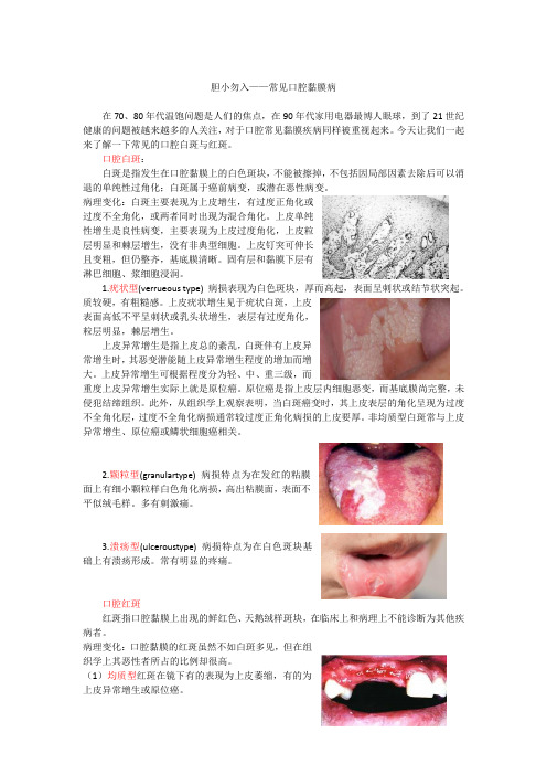 口内黏膜病-红斑白斑