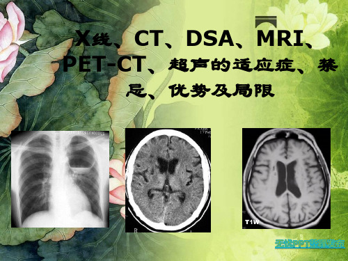 X线CT DSA  MRI PET-CT 超声的适应症、禁忌、优势及缺点