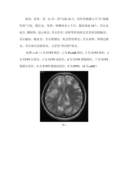 颅内多发环形强化占位病变MRI影像诊断及鉴别诊断--结核性肉芽肿