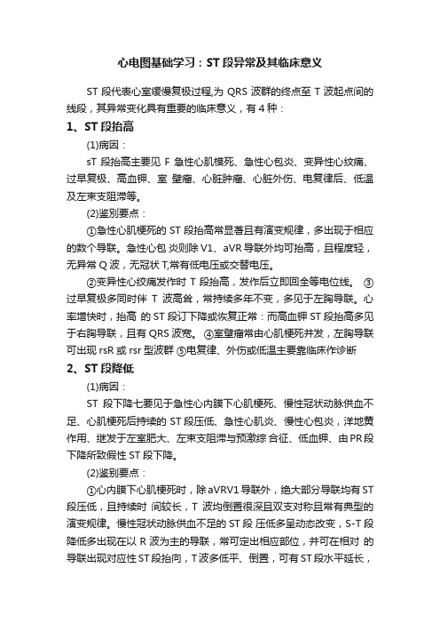 心电图基础学习：ST段异常及其临床意义