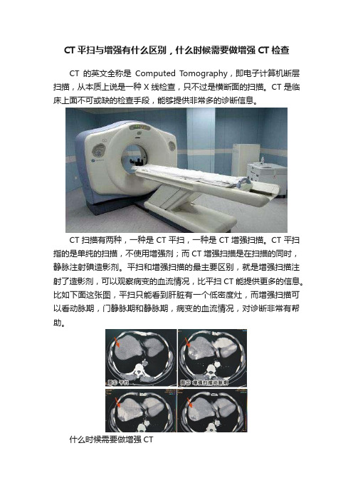 CT平扫与增强有什么区别，什么时候需要做增强CT检查