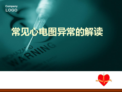 常见心电图的解读