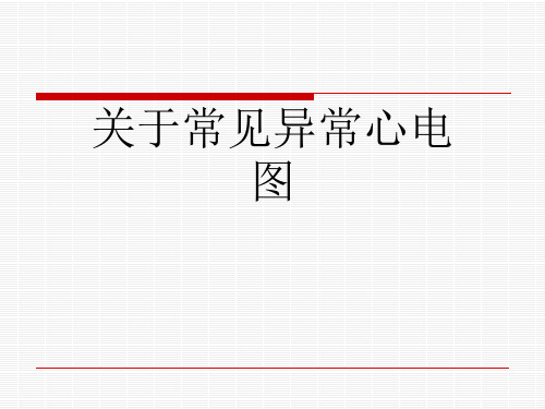 关于常见异常心电图