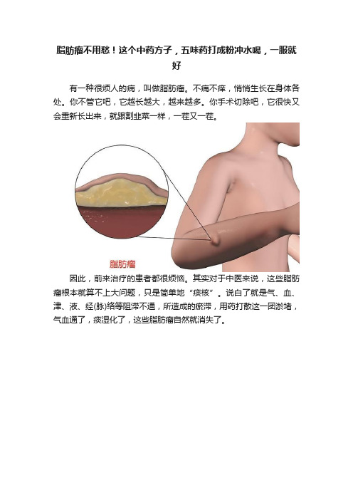 脂肪瘤不用愁！这个中药方子，五味药打成粉冲水喝，一服就好