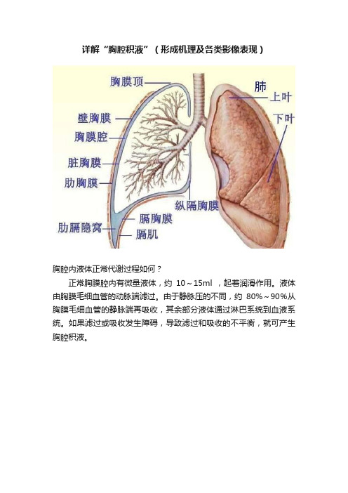 详解“胸腔积液”（形成机理及各类影像表现）