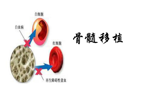 骨髓移植业务学习