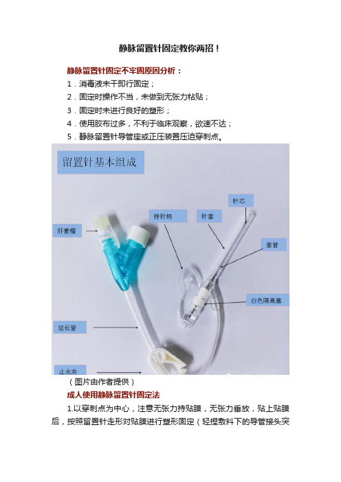 静脉留置针固定教你两招！