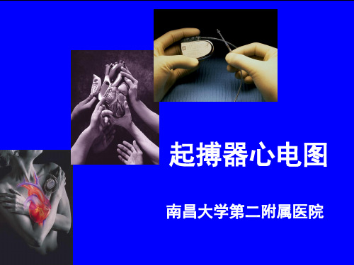 常见起搏器心电图解读PPT演示幻灯片