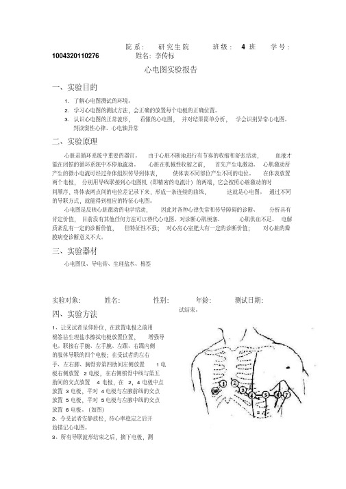 心电图试验报告