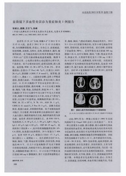 显微镜下多血管炎误诊为重症肺炎1例报告