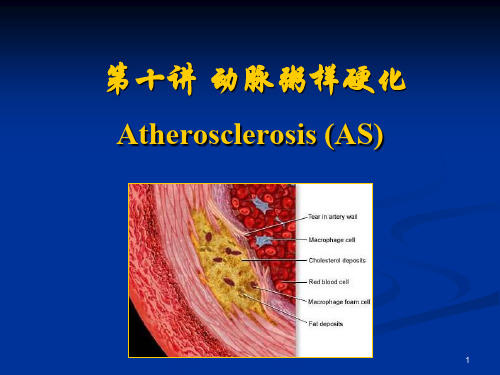 高级病理学-动脉粥样硬化