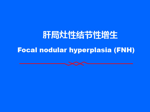 fnh肝局灶性结节性增生-PPT课件