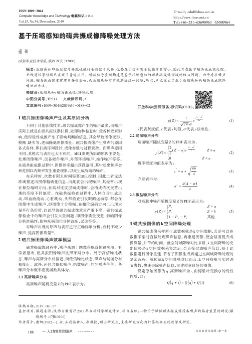 基于压缩感知的磁共振成像降噪处理方法