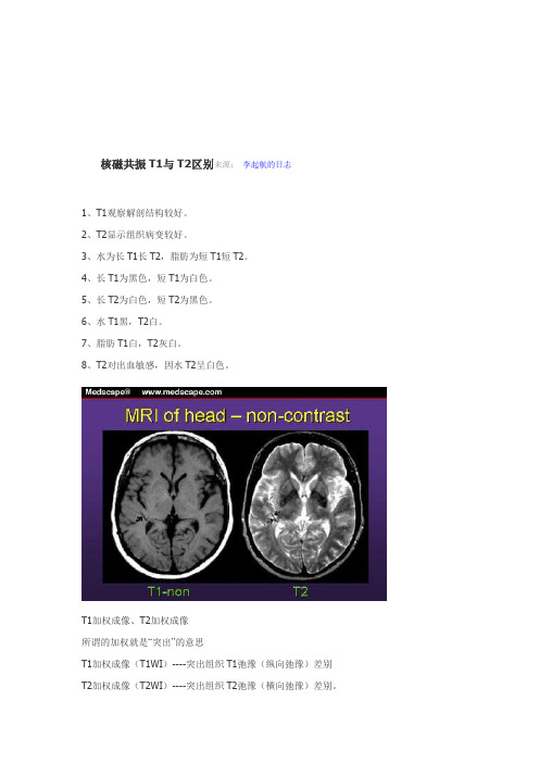 核磁共振T1与T2区别