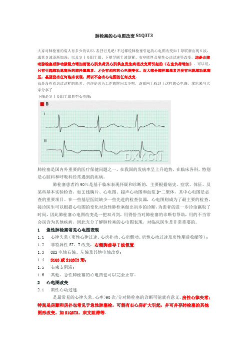 肺栓塞的心电图改变S1Q3T3