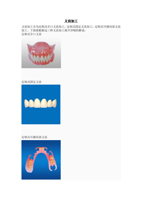 义齿加工