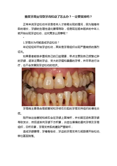 重度牙周炎导致牙齿松动了怎么办？一定要拔掉吗？