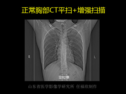 胸部CT扫描动态演示(含标注)-任福欣