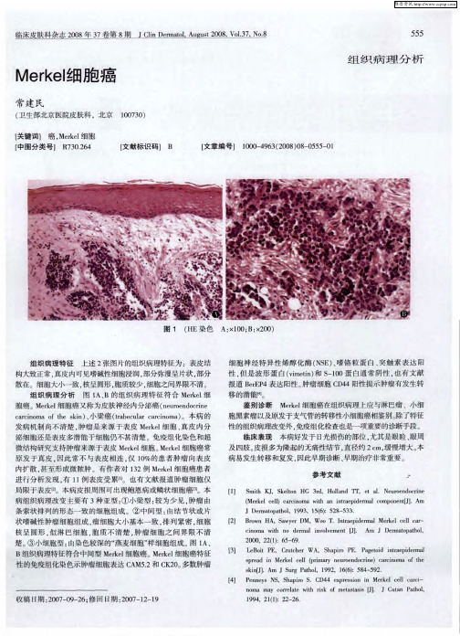 Merkel细胞癌