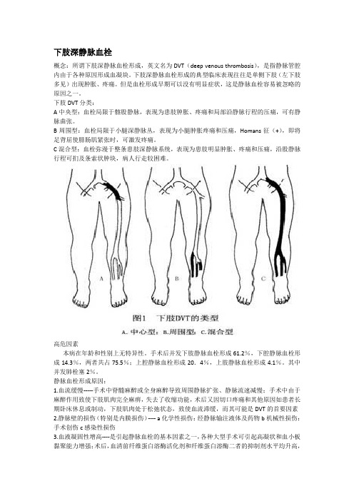 下肢深静脉血栓DVT