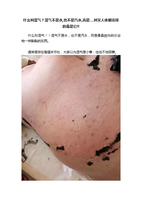 什么叫湿气？湿气不是水,也不是汽水,而是....其实人体最该排的毒是它!!