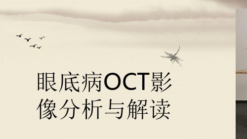 眼底病OCT解读PPT演示幻灯片