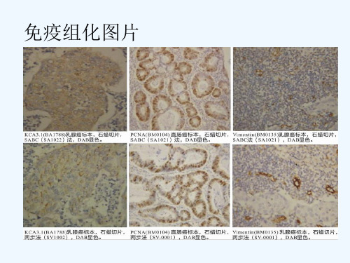 免疫组化和荧光