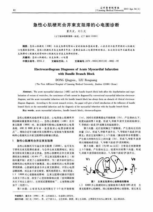 急性心肌梗死合并束支阻滞的心电图诊断