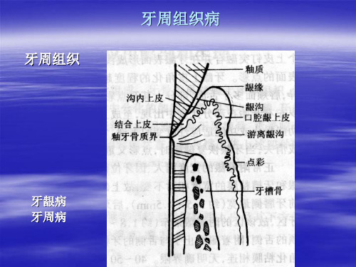 口腔组织病理学课件：牙周组织病