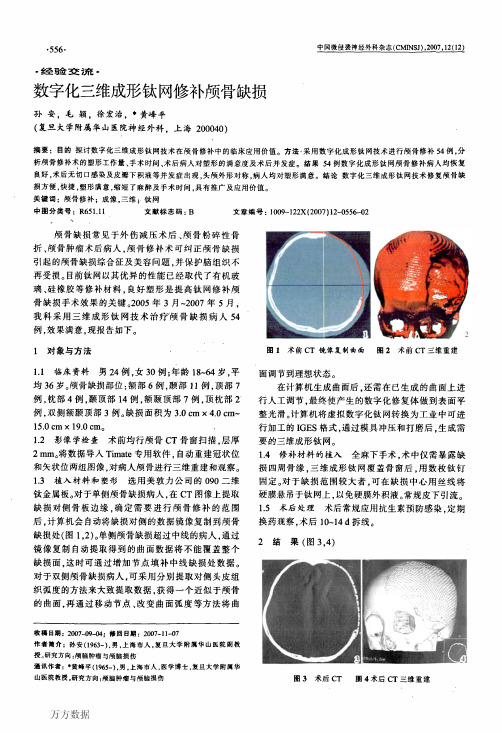 数字化三维成形钛网修补颅骨缺损