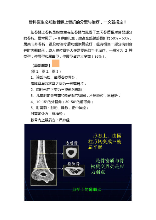 骨科医生必知肱骨髁上骨折的分型与治疗，一文就搞定！