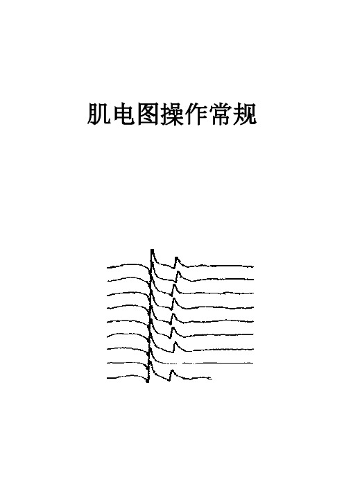 肌电图操作常规