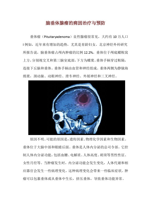 脑垂体腺瘤的病因治疗与预防