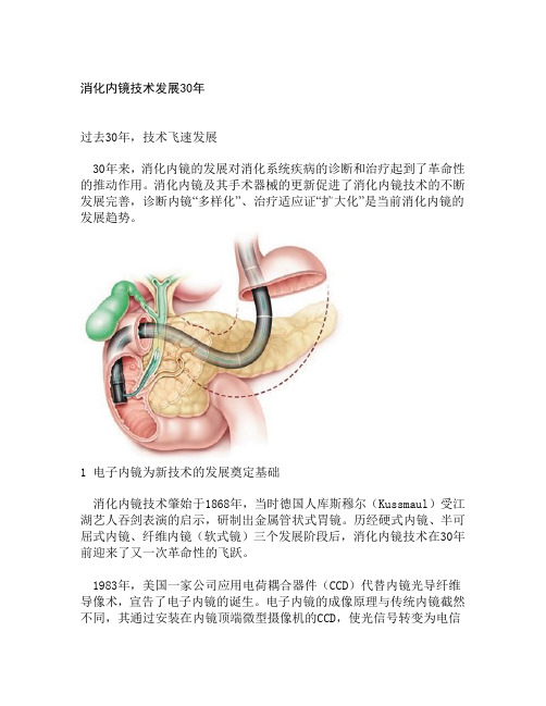 消化内镜技术发展30年题库