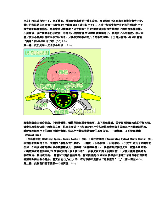 怎样自己也能看懂CT和MRI磁共振片子