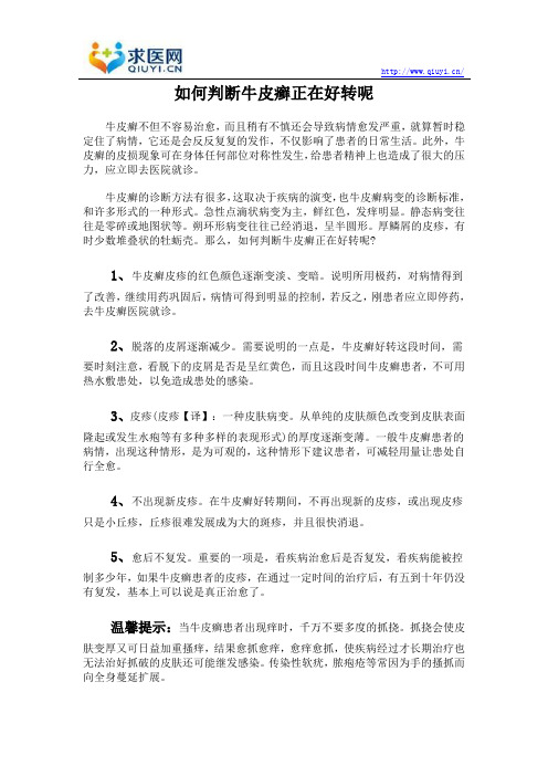 如何判断牛皮癣正在好转呢