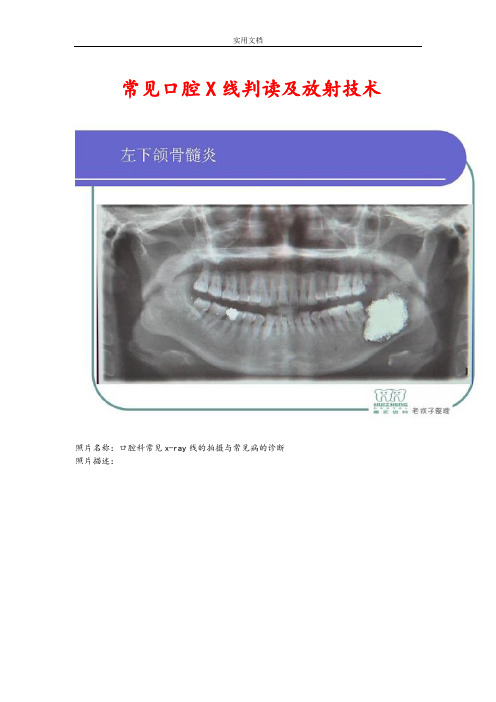 常见口腔X线判读及放射技术