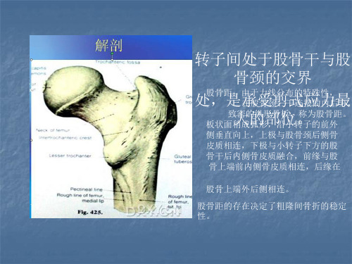 2018年股骨转子间骨折的分型与治疗 ppt课件-2019年医学文档资料