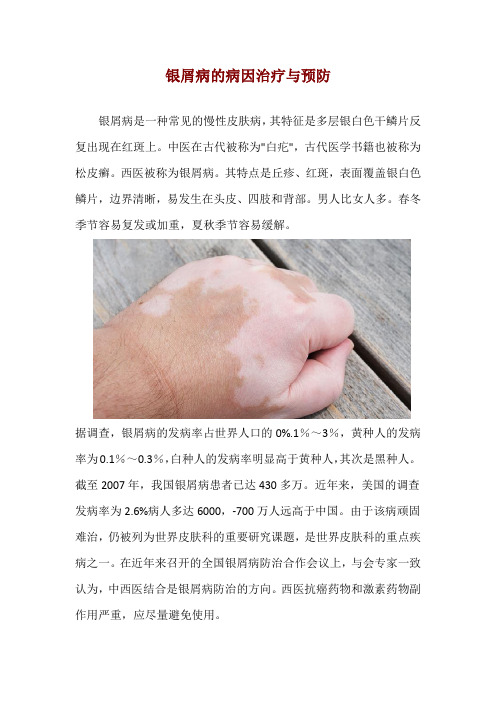 银屑病的病因治疗与预防