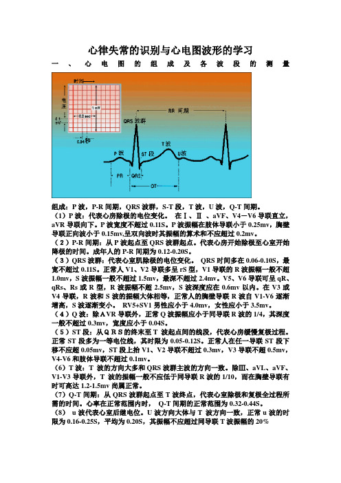 心律失常的识别与心电图波形的学习