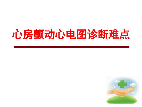 心房颤动心电图诊断难点1