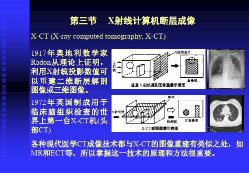 第二章 X射线影像_X射线计算机断层成像