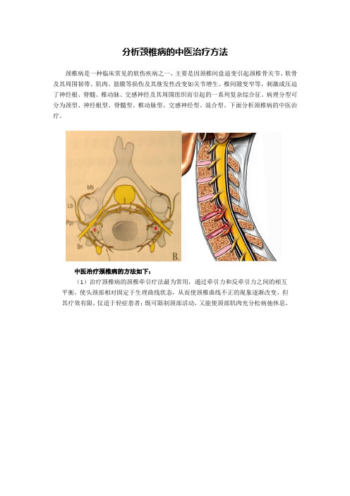 分析颈椎病的中医治疗方法