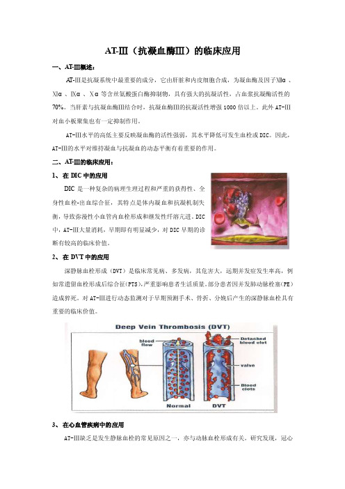 AT-III临床意义