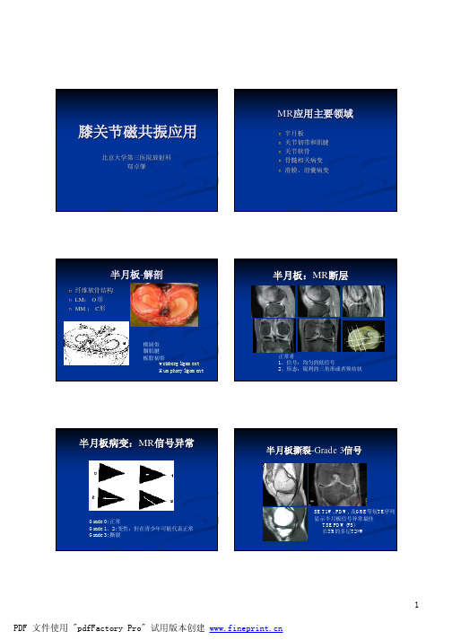 膝关节磁共振应用-北京大学学第三医院放射科郑卓肇