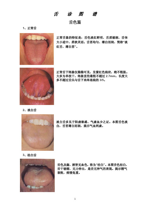 舌诊图谱