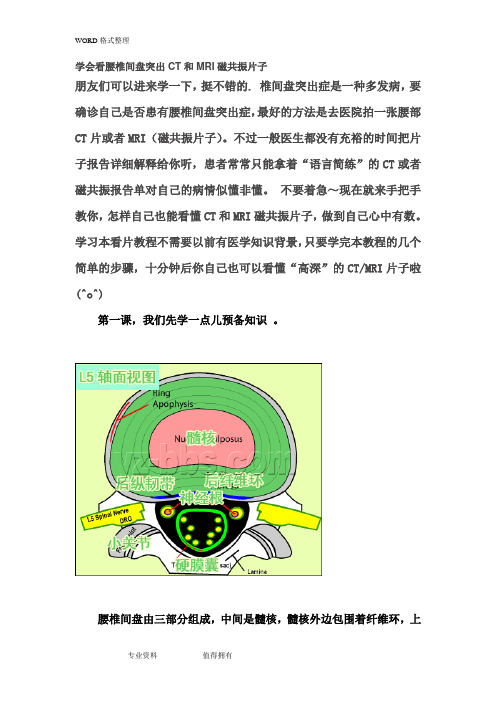 学会看腰椎间盘突出CT和MRI磁共振片子