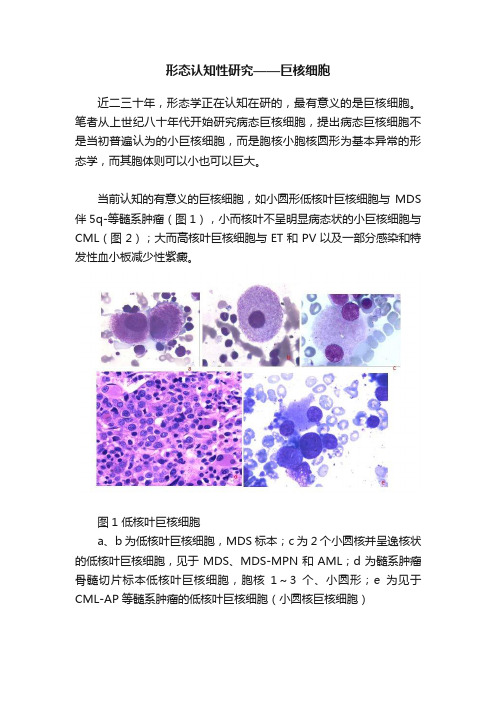 形态认知性研究——巨核细胞