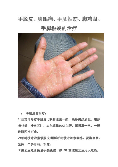 手脱皮难得的偏方